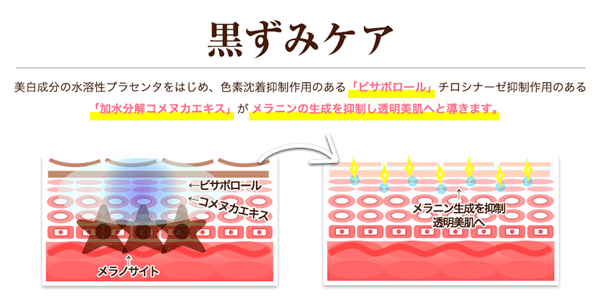 モニター